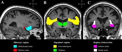 Specific structural changes in Parkinson’s disease-related olfactory dysfunction compared to others forms of olfactory dysfunction